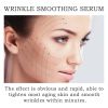 Wrinkle Reducing Serum  Firming Facial Skin  Diminishing Fine Lines & Headlines   Brightening Complexion Serum